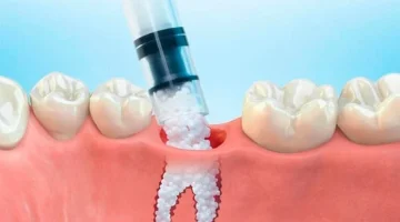 Стоматологическая клиника Dental Hall изображение 1