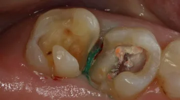 Стоматологическая клиника Dental Hall изображение 3